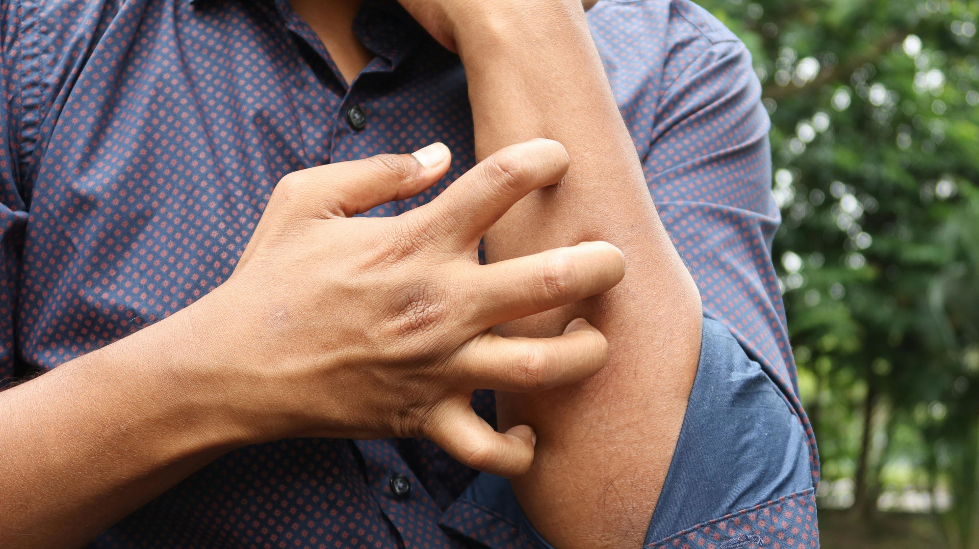 Body Rash