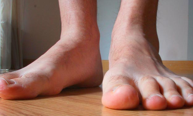 A Mans Stinky Feet.