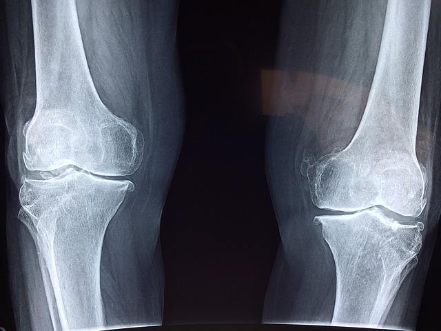 Bone scan of healthy knees